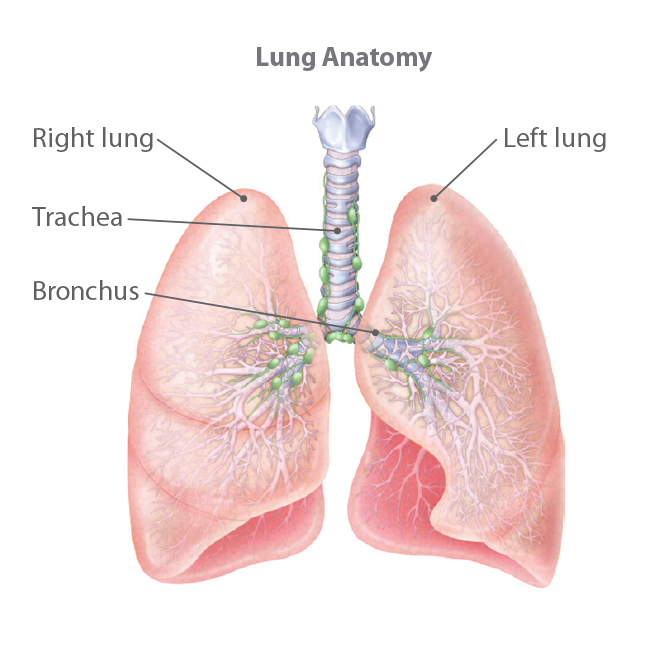 Understanding Lung Cancer 1