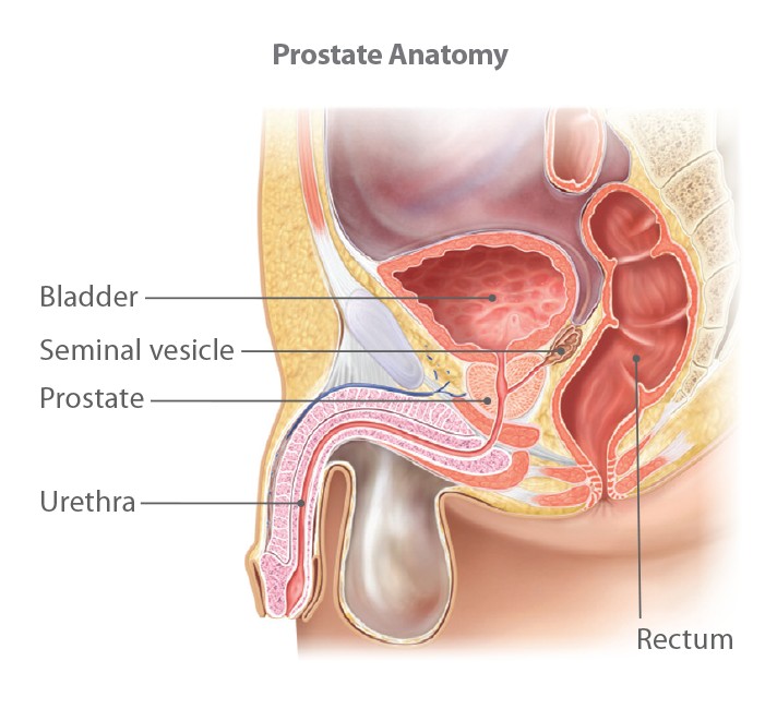 Understanding Prostate Cancer 1