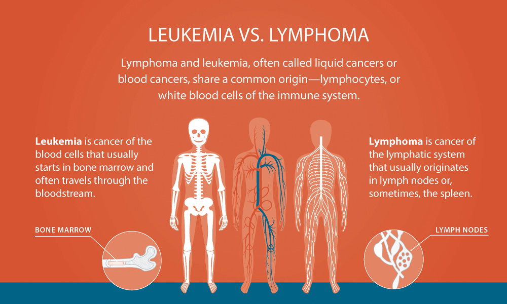 Visual guide to the differences in where leukemia and lymphoma originate