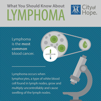 hodgkin lymphoma infographic