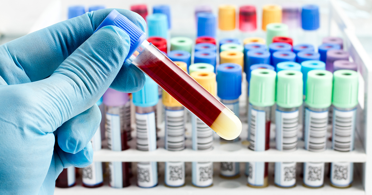 A simple blood test may help illustrate a patient's cancer | CTCA