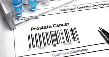 Prostate cancer treatment