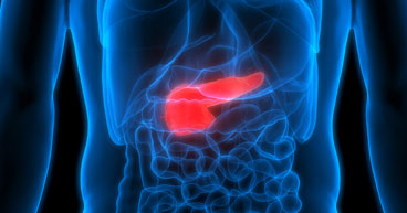 What conditions may contribute to high risk of pancreatic cancer? 