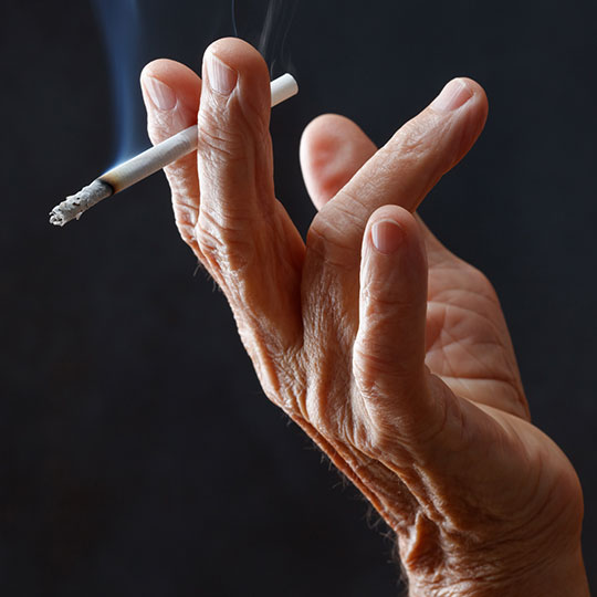 Smoking is a leading risk factor for cancer.