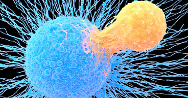 What happens if CAR T-cell therapy fails?