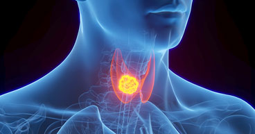 Why thyroid cancer patients may need a low-iodine diet