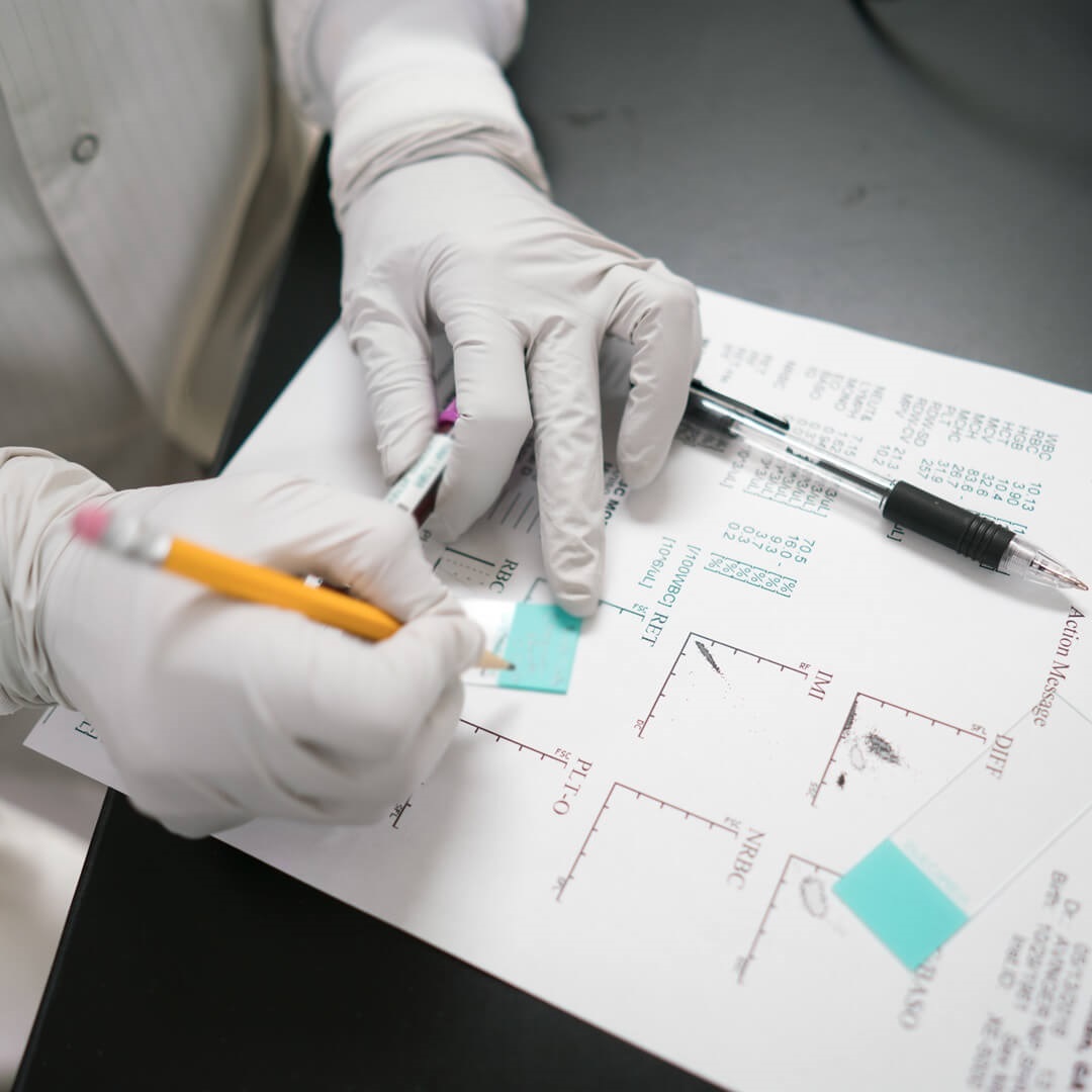 scientist writing out action message for cancer diagnosis and treatment